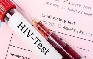 تعداد بیماران مبتلا به ایدز در کشور اعلام شد ؛ تفاوت قابل توجه تعداد مردان و زنان مبتلا به HIV (اچ‌آی‌وی)