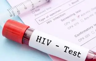 روش جدید پیشگیری از HIV؛ کاهش خطر ابتلا تا ۹۶ درصد