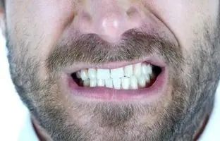 کمبود کدام ویتامین باعث پوسیدگی دندان می‌شود؟