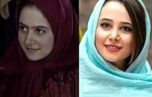 تغییرات باورنکردنی بازیگران زن ایرانی پس از عمل زیبایی + ویدئو