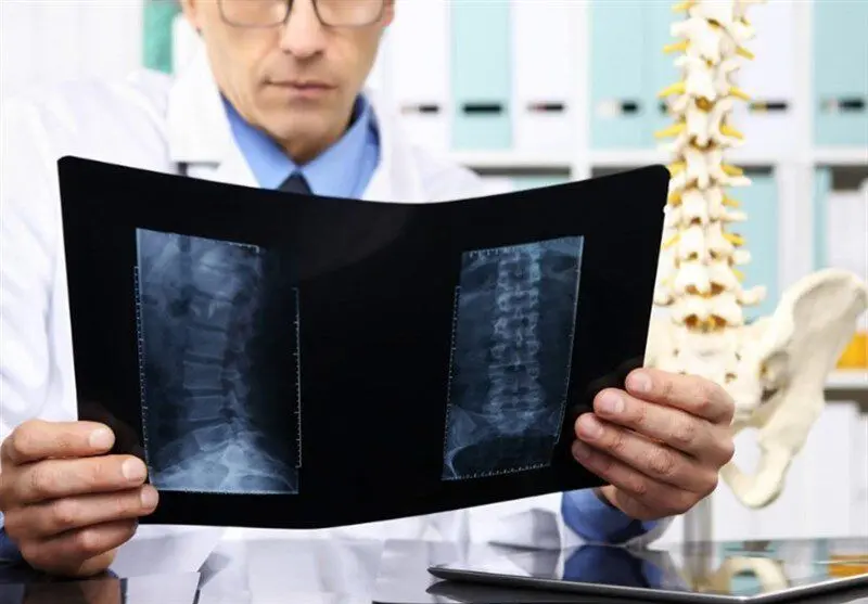 ورزش را از این سن شروع کنید تا پوکی استخوان نگیرید 