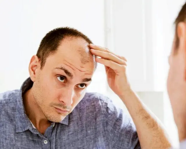 چند باور نادرست درباره ریزش مو
