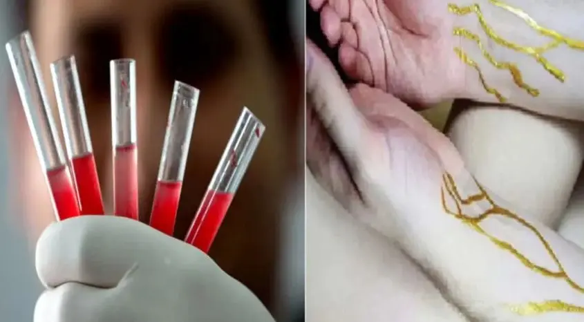 گروه خونی طلایی چیست؟ آیا شما هم گروه خونی طلایی دارید؟