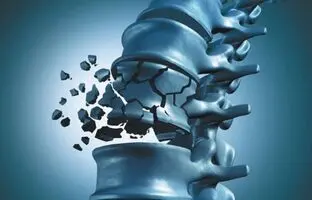 چگونه از شر پوکی استخوان راحت شویم؟