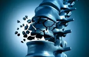 چگونه از شر پوکی استخوان راحت شویم؟