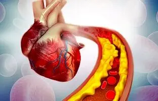 علائم نارسایی قلبی کدامند؟