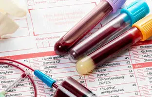 با یک آزمایش خون بفهمید چقدر تا مرگ فاصله دارید