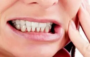 بهترین روش درمان دندان قروچه + ویدئو