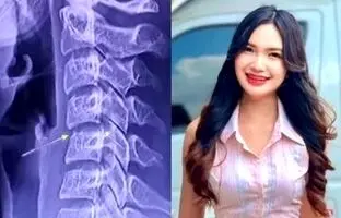ماساژ گردن، خواننده تایلندی را به کشتن داد + تصویر