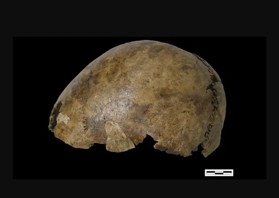 آیا اسکلت مرموز و وصله‌کاری شده 2500 ساله یک هیولای فرانکنشتاین است؟