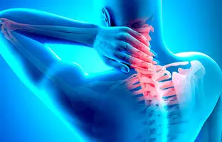 رایج ترین علائم دیسک گردن کدامند؛ چه زمانی به پزشک مراجعه کنیم؟