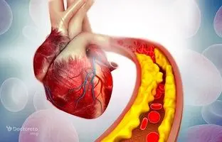 نشانه‌هایی که نشان می‌دهد اطراف قلب شما چربی وجود دارد 