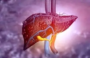 از کجا بفهمیم کبد چرب داریم؟ + ویدئو