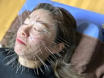 (عکس) عجیب و غریب؛ روش جدید استفاده از طب سوزنی در ژاپن