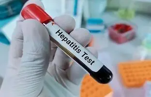 هپاتیت چگونه منتقل می‌شود؟ راه‌های پیشگیری از آن چیست؟