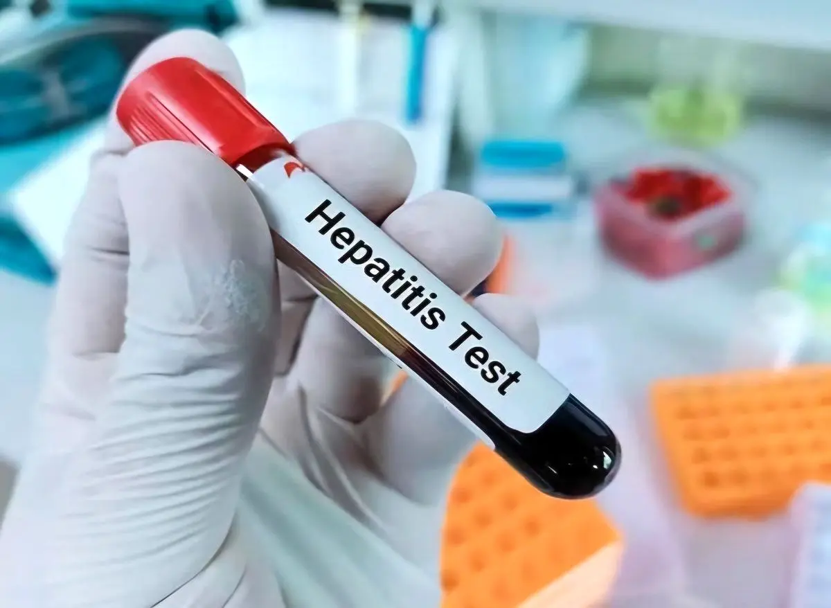 هپاتیت چگونه منتقل می‌شود؟ راه‌های پیشگیری از آن چیست؟