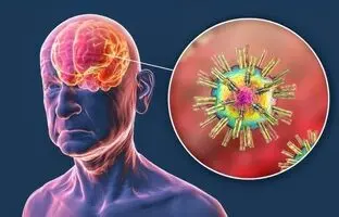 
ضربه به سر، ویروس‌های خفته مغز را بیدار می‌کند
