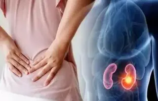 این بیماری هیچ علائمی ندارد؛ تشخیص آن فقط با سونوگرافی + ویدئو