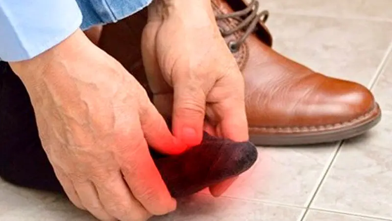 ۱۵ روش برای بزرگتر کردن کفش‌های تنگ در خانه