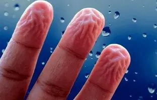 چرا پوست انگشتانمان در آب چروک می‌شود؟ پاسخ در اعماق مغز نهفته است!