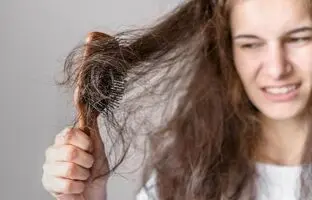 اصلی‌ترین علل ریزش مو در بانوان + ویدئو