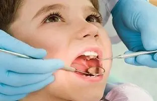 شیوع پوسیدگی دندان از کجا نشات می‌گیرد؟