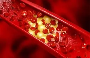  چطور آزمایش چربی خون‌مان را تفسیر کنیم؟ + ویدئو