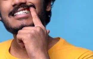 ۷ روش خانگی برای پاک کردن لکه های قهوه ای روی دندان