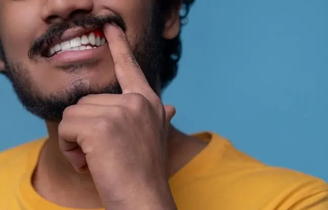 ۷ روش خانگی برای پاک کردن لکه های قهوه ای روی دندان