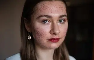 ۱۶ کار رایجی که در واقع باعث آسیب شدید به پوست صورت می‌شوند
