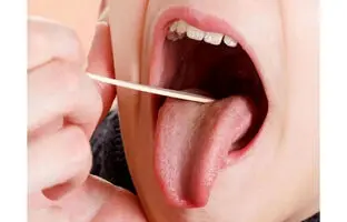 از روی زبان کمبود ویتامین دی را تشخیص دهید! 