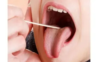  از روی زبان کمبود ویتامین دی را تشخیص دهید! 