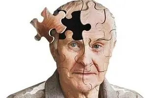 راه‌حل دانشمندان بلژیکی برای پیش‌بینی آلزایمر خانوادگی
