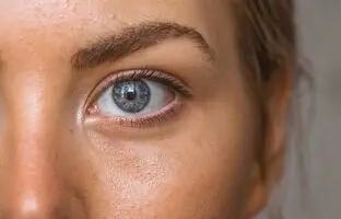 پوست چرب و راه‌های مراقبت از آن