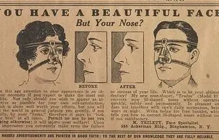  اولین جراحی زیبایی تاریخ کِی انجام شد؟/ استفاده از پوست پیشانی برای ترمیم بینی‌های قطع‌شده در مجازات‌ها