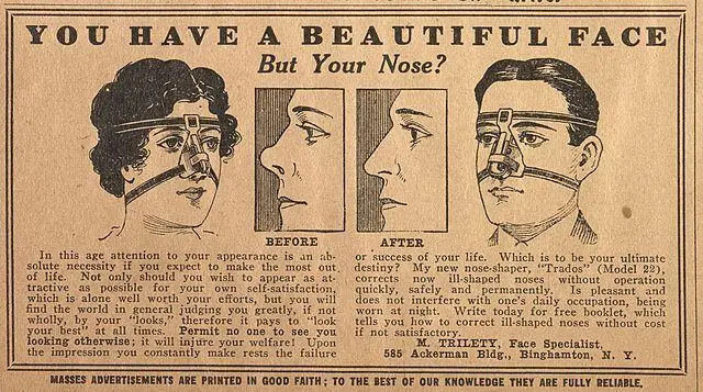  اولین جراحی زیبایی تاریخ کِی انجام شد؟/ استفاده از پوست پیشانی برای ترمیم بینی‌های قطع‌شده در مجازات‌ها