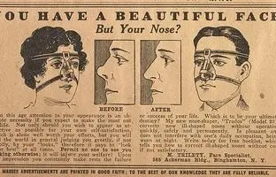  اولین جراحی زیبایی تاریخ کِی انجام شد؟/ استفاده از پوست پیشانی برای ترمیم بینی‌های قطع‌شده در مجازات‌ها