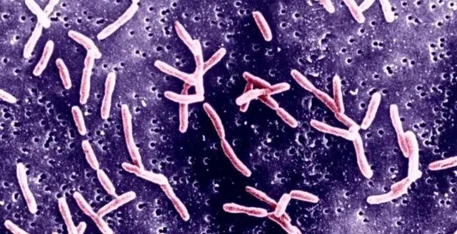 «سندرم گیلن باره»: هند با شیوع یک بیماری‌ فلج‌کننده روبروست
