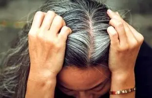 علت سفید شدن موها در سن پایین چیست؟