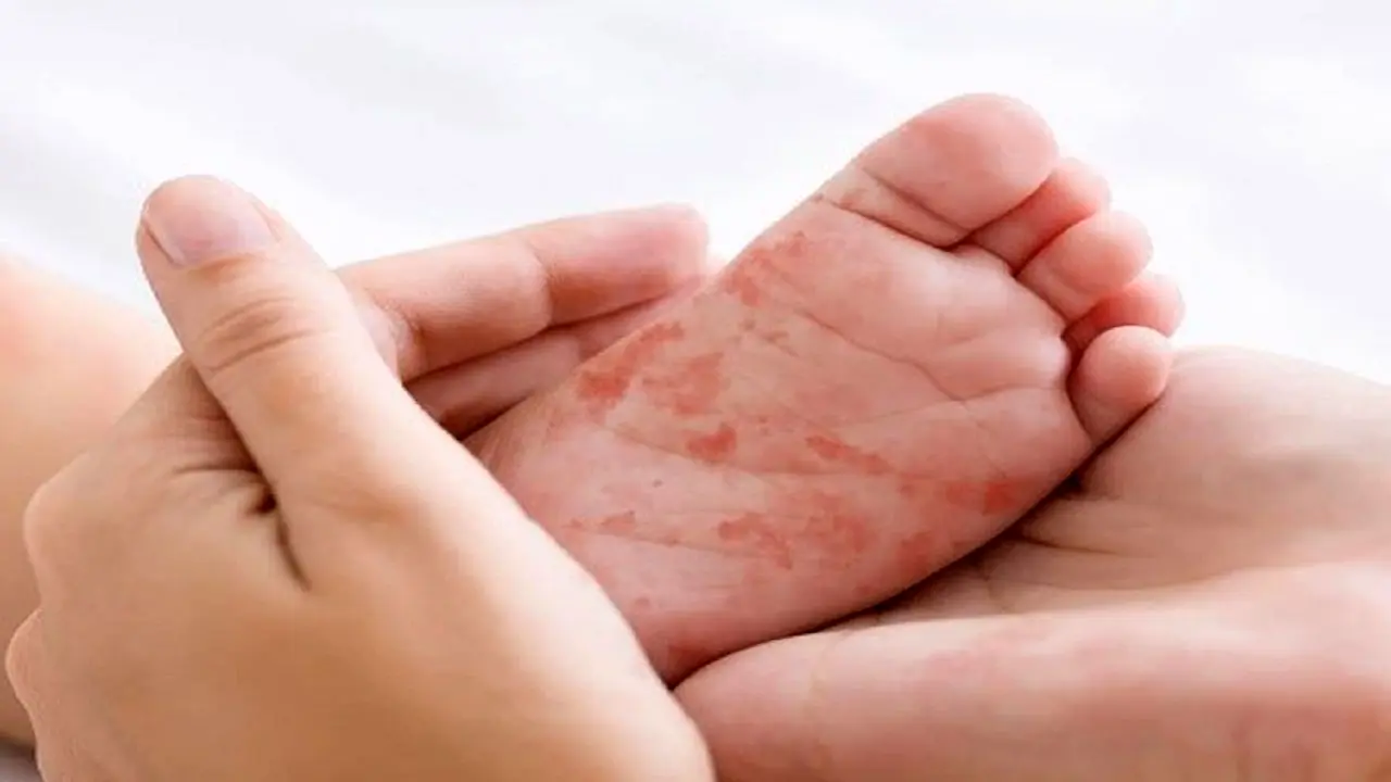 ای بی چیست؟