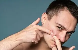پنج ماده‌ای که به مبارزه با آکنه کمک می‌کند