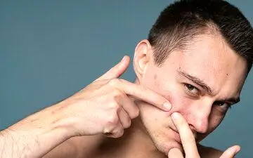 پنج ماده‌ای که به مبارزه با آکنه کمک می‌کند