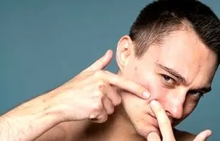 پنج ماده‌ای که به مبارزه با آکنه کمک می‌کند