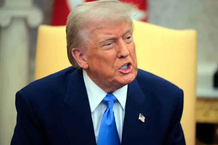 کبودی دست ترامپ خبرساز شد