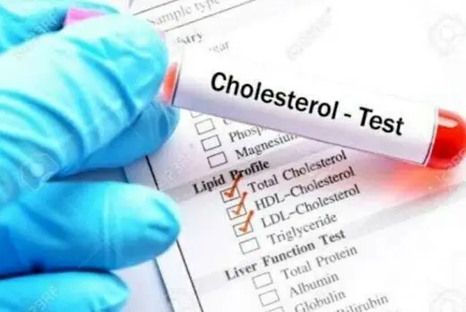 شیر برای کلسترول بالا مفید است یا مضر؟