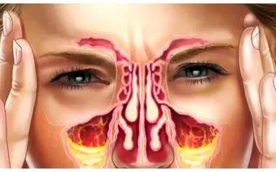 رنگ مخاط نشانه چه بیماری هایی در بدن است؟
