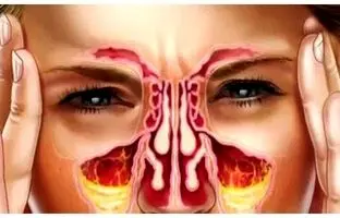 رنگ مخاط نشانه چه بیماری هایی در بدن است؟
