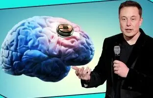 
ایلان ماسک: با تراشه نورالینک مرگ دیگر معنایی ندارد
