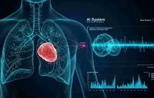 هوش مصنوعی که تومورهای پنهان ریه را حتی بهتر از پزشکان شناسایی می‌کند

