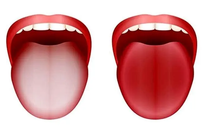 زبان سفید چه چیزی درباره سلامت می‌گوید؟